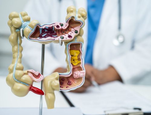 Colon Polyps Found? Exploring Outpatient Endoscopic Resection Options