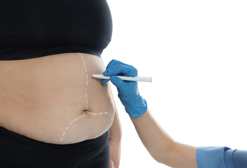 mackinaw surgery center From Tummy Tucks To Liposuction 3 Tips For Body Contouring